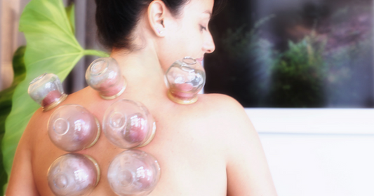 Cupping is Chinese for Flu Shot