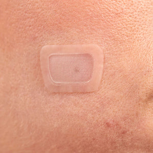 Miracle Patch Microcrystal Dark Spot Cover